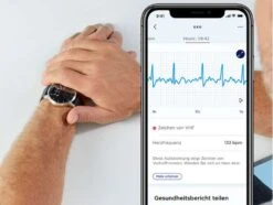 [CB] Withings ScanWatch Hybrid-Smartwatch, 42 Mm, Weiß -Elektronische Geräte Verkäufe 2283464 1 2